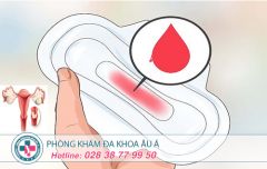 Hiện tượng chảy máu ở cổ tử cung nguy hiểm như thế nào?