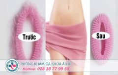 Thu hẹp vùng kín ở đâu an toàn, bảo mật tại TPHCM?