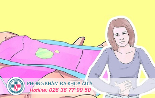 3 cách chữa dứt điểm huyết trắng màu vàng