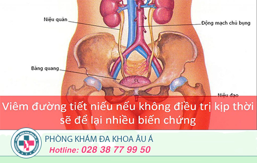 Cách điều trị viêm đường tiết niệu ở nữ