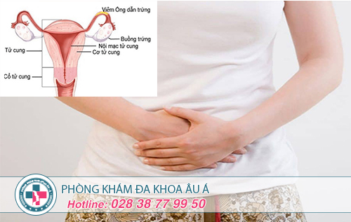 Cẩn trọng với viêm ống dẫn trứng