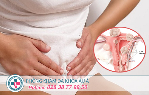 Chi phí chữa u xơ tử cung hết bao nhiêu tiền?