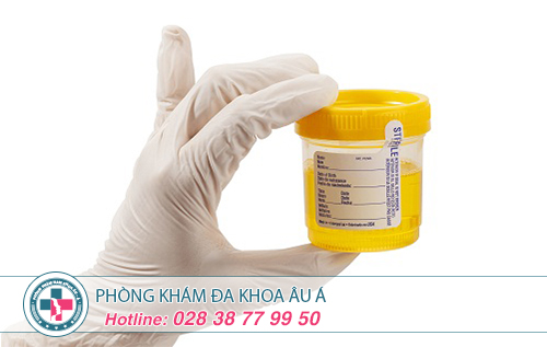 Điều trị viêm đường tiết niệu ở đâu tốt TPHCM?