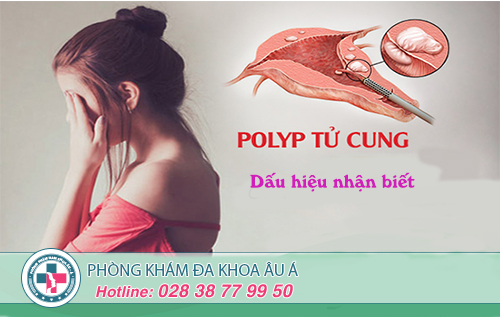 Dấu hiệu polyp cổ tử cung mà bạn không nên bỏ qua