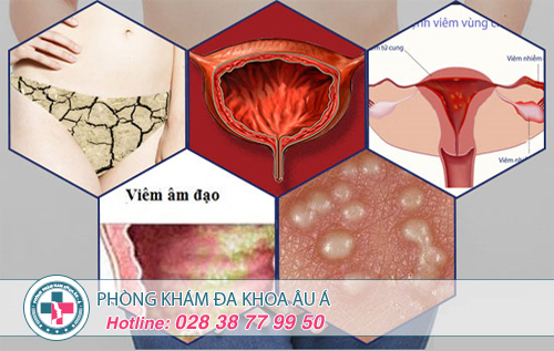 Đau rát âm đạo triệu chứng không nên bỏ qua