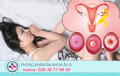 Địa chỉ chữa viêm cổ tử cung uy tín