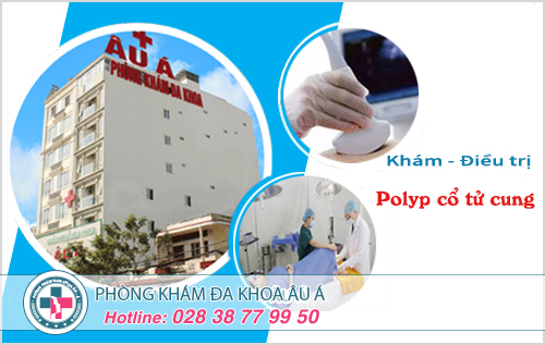 Địa chỉ điều trị polyp cổ tử cung chất lượng