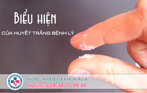 Điều Trị Huyết Trắng Thất Thường Ở Đâu Tốt  Tại TP. HCM