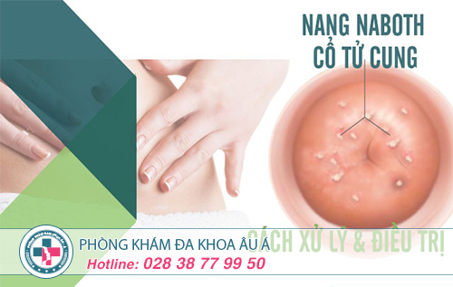 Điều trị nang naboth cổ tử cung