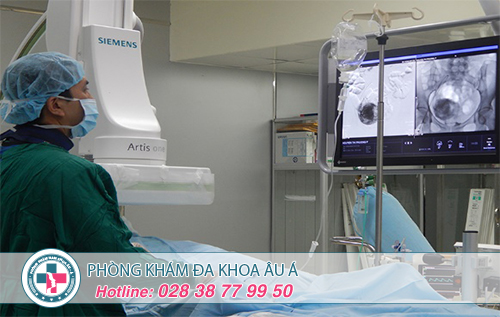 Giải pháp điều trị u xơ tử cung hiệu quả