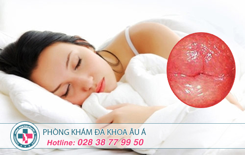 Hình ảnh cổ tử cung bình thường và cổ tử cung bị viêm