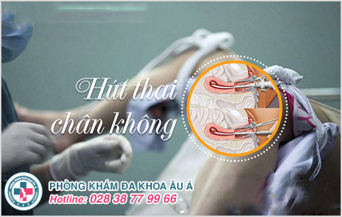 Hút thai theo tháng an toàn được tiến hành thế nào?