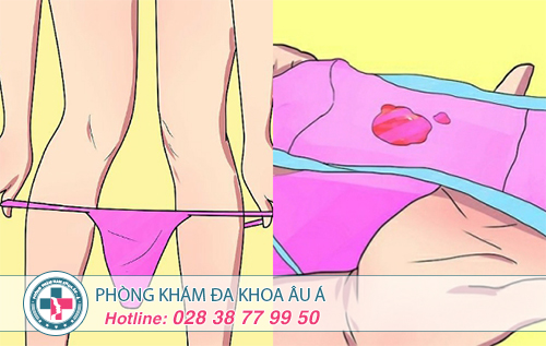 Huyết trắng bất thường
