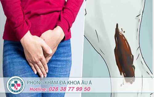 Huyết trắng có màu kèm mùi hôi