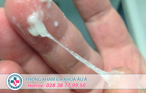 Huyết trắng nhiều có phải dấu hiệu nguy hiểm?