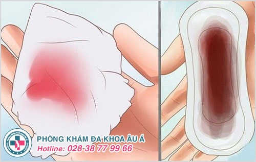[Bật mí] cách nhận biết có thai sớm nhất mà chị em cần biết