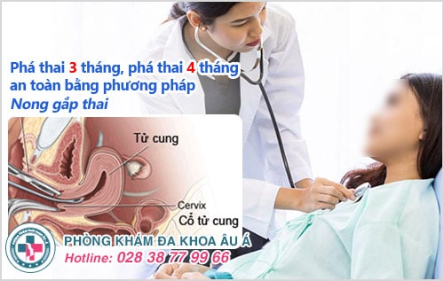 Bỏ thai lớn có ảnh hưởng gì không? Phương pháp bỏ thai 4, 5 tháng an toàn