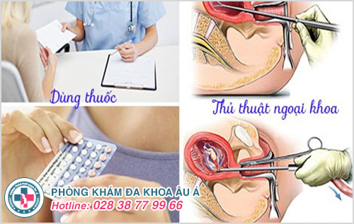 Phương pháp phá thai