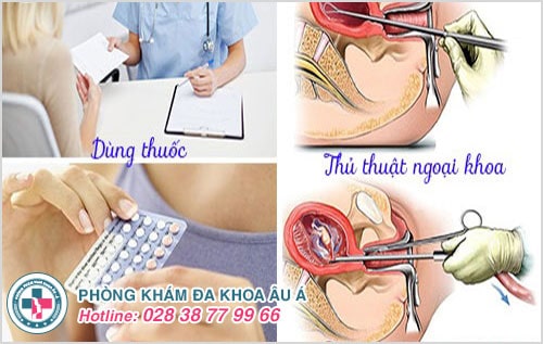 Có thai ngoài ý muốn phải làm sao?