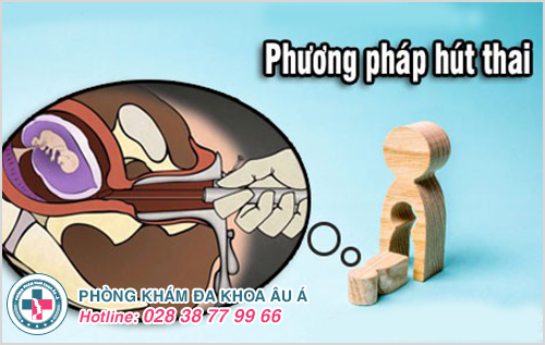 Làm rõ phương pháp hút thai an toàn hiện nay