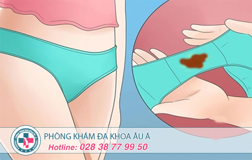 Khí hư có màu nâu là bệnh gì?