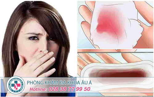 Khí hư có mùi tanh là bị gì?