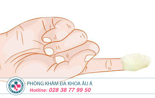 Khí hư đặc sệt, vón cục và có mùi hôi khó chịu là dấu hiệu bệnh gì?