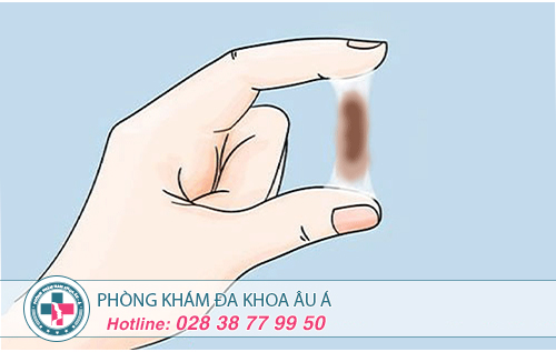 Khí Hư Màu Nâu Là Triệu Chứng Của Bệnh Gì?