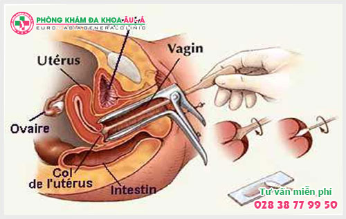 Biểu hiện viêm âm đạo như thế nào?