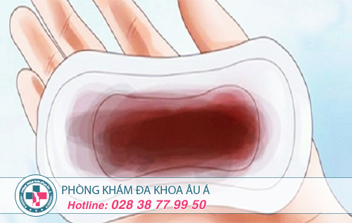 Kinh nguyệt màu đen là dấu hiệu của bệnh gì?