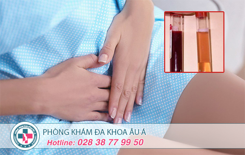 Lý Giải Hiện Tượng Tiểu Buốt Tiểu Ra Máu Ở  Nữ Giới