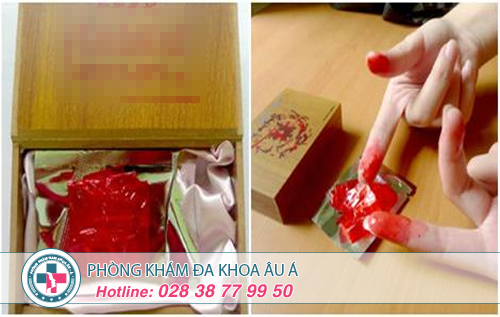 Màng trinh giả khôi phục trinh tiết trong 5 phút