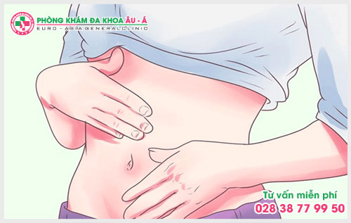 Ngăn ngừa bệnh viêm phần phụ hiệu quả
