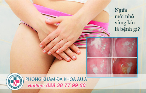 Ngứa môi nhỏ vùng kín có phải dấu hiệu cảnh báo bệnh?
