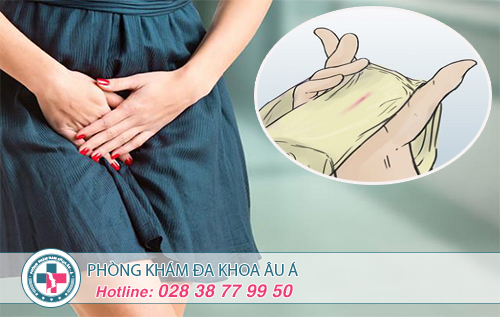 Ngứa vùng kín, ngứa mép vùng kín do đâu?