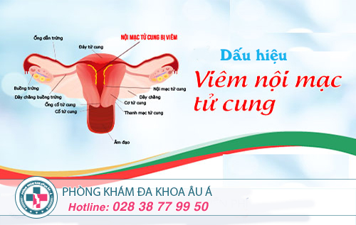 Những dấu hiệu viêm nội mạc tử cung mà bạn cần chú ý