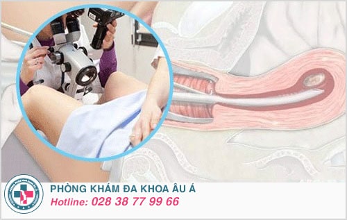 phá thai 10 tuần
