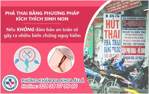 Phá thai bằng phương pháp kích thích sinh non là như thế nào?