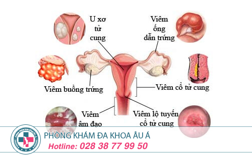 Phòng khám phụ khoa tốt nhất TPHCM