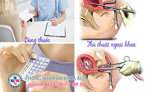 Phương pháp phá thai và địa chỉ phá thai an toàn
