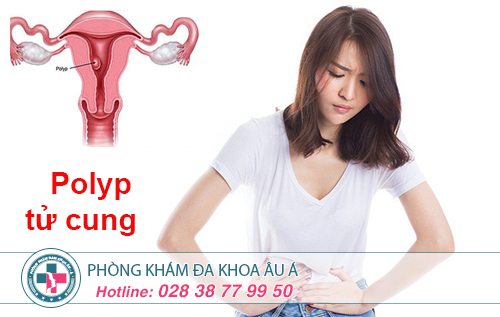 Polyp cổ tử cung cách điều trị ra sao?
