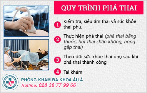 Quy trình phá thai an toàn, hồi phục nhanh
