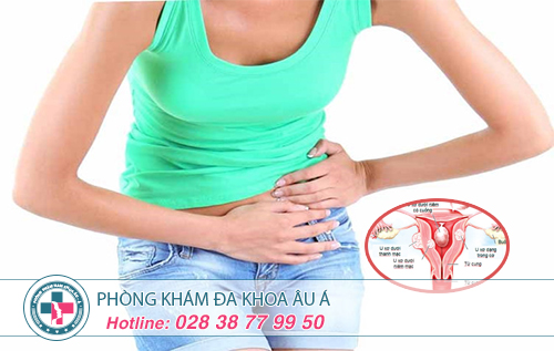 Tất tần tật thông tin về chi phí điều trị u xơ tử cung