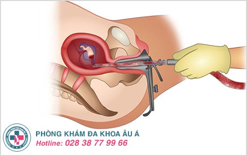 Hút thai chân không phù hợp với thai từ 8 - 12 tuần tuổi