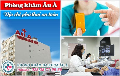Thuốc phá thai khẩn cấp giá bao nhiêu?