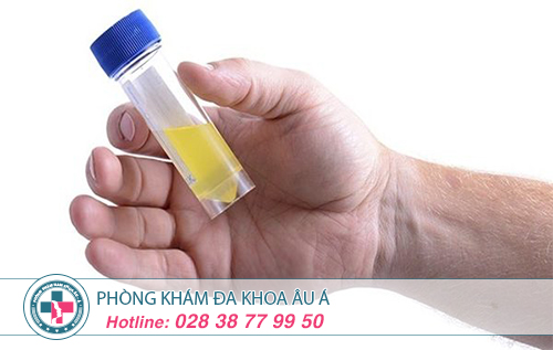 Tiểu nhiều ở nữ giới - Biểu hiện bất thường cần đề phòng