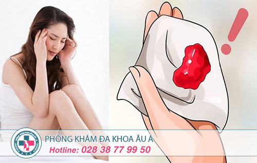 Triệu chứng và dấu hiệu của kinh nguyệt không đều