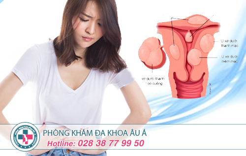 U xơ tử cung chữa ở đâu uy tín, chất lượng