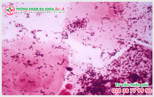 Viêm âm đạo do trùng roi và cách điều trị tốt 