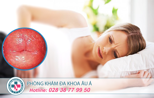 Chi phí chữa viêm cổ tử cung là bao nhiêu?